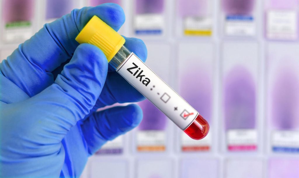 Zika virus