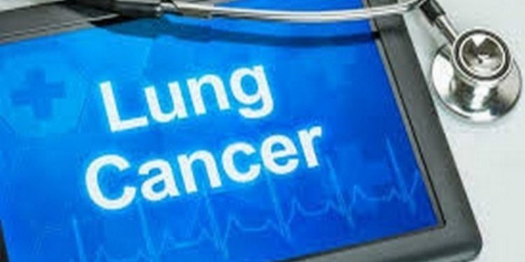 lung cancer