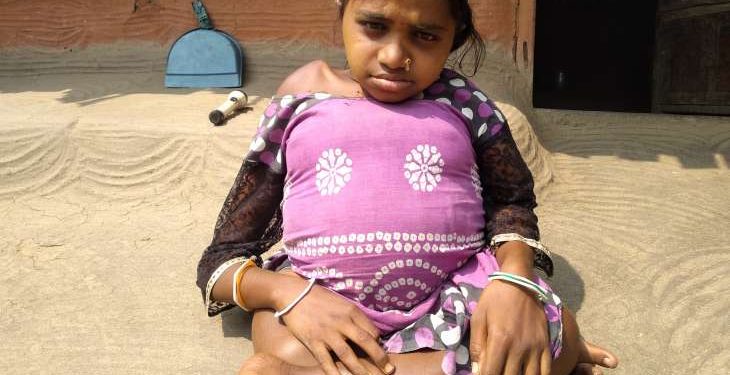 Poverty stands between treatment and a physically challenged daughter, parents in distress