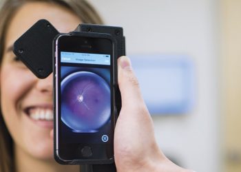 Smartphone, AI may help detect diabetic retinopathy