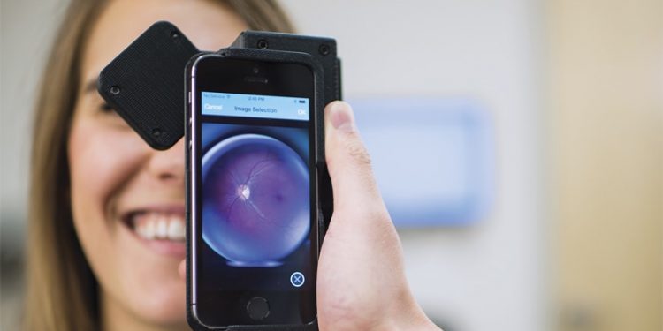 Smartphone, AI may help detect diabetic retinopathy