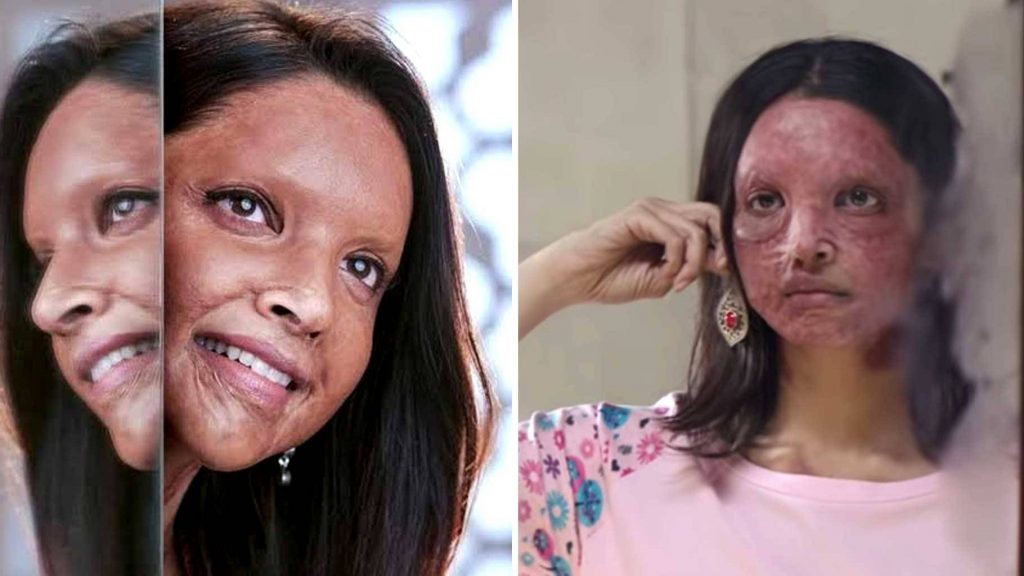 'Chhapaak' taken to Bombay HC over writing credit