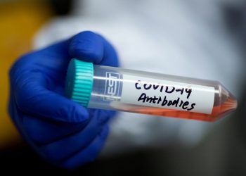 Study says men produce more COVID antibodies than women