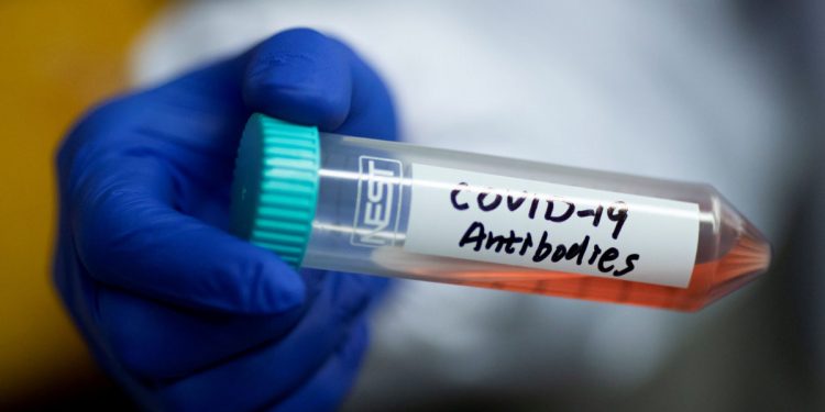 Study says men produce more COVID antibodies than women