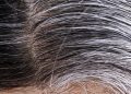 Gray hair