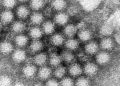 Norovirus AP