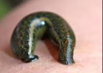 Leech therapy